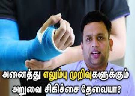 யாருக்கு எலும்பு முறிவு அறுவை சிகிச்சை செய்யலாம்?
