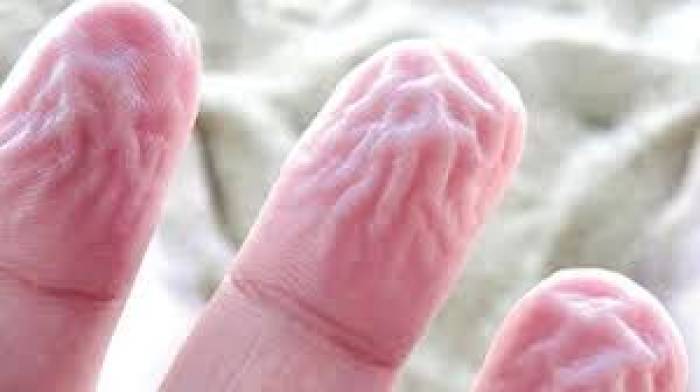 ஏன் தண்ணீருக்குள் கைகளை வைத்திருக்கும் போது தோல் சுருங்குகிறது.?
