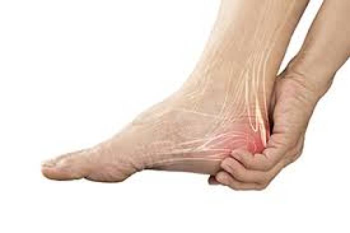 குதிகால் வலி (Calcaneal Spur) - காரணங்களும் தீர்வுகளும்...