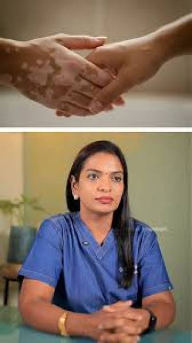 வெண்புள்ளிக்கு மாத்திரை வந்தாச்சு!